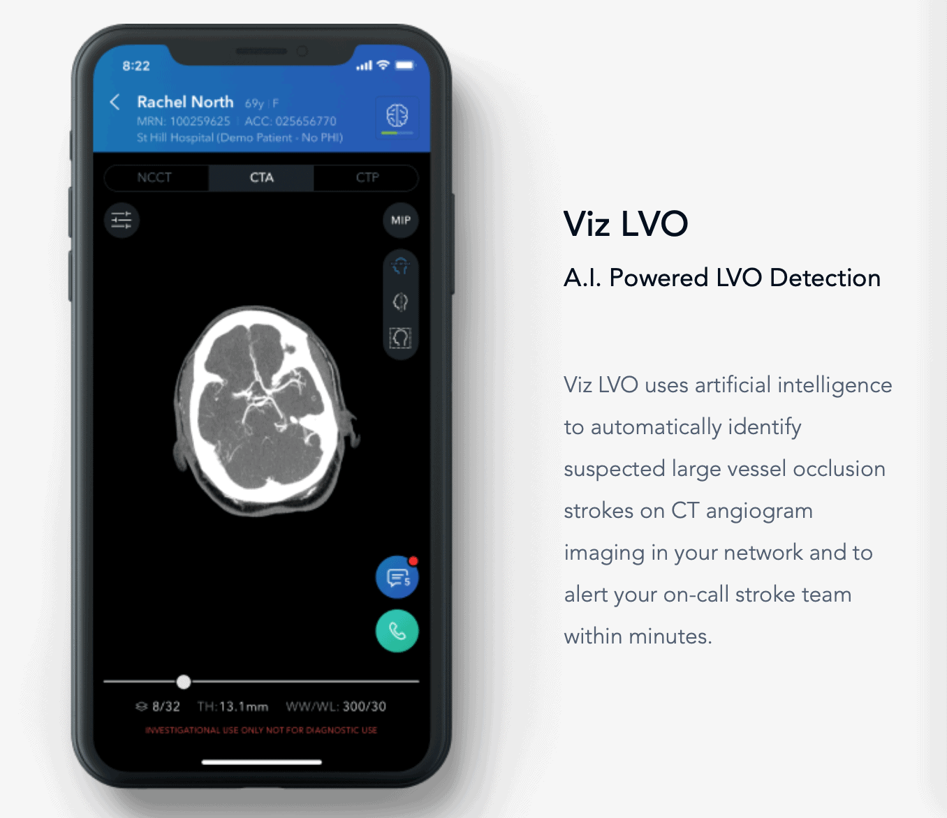 how-ai-is-able-to-predict-and-detect-a-stroke-referralmd